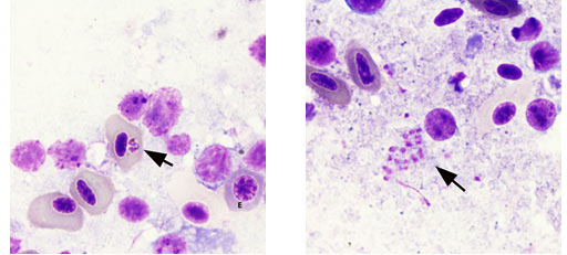 Merel (Turdus merula) besmet met malaria parasiet